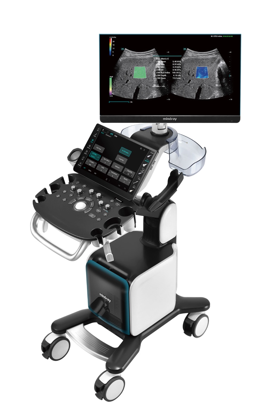 Consona N9 Diagnostic Ultrasound System - ZST+ Platform - Extraordinary ultrasound evolution with channel data processing