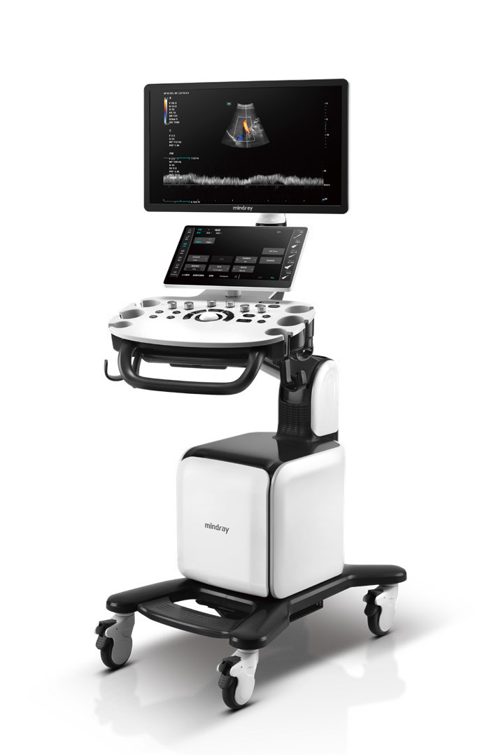 Consona N6 Diagnostic Ultrasound System - ZST+ Platform - Extraordinary ultrasound evolution with channel data processing